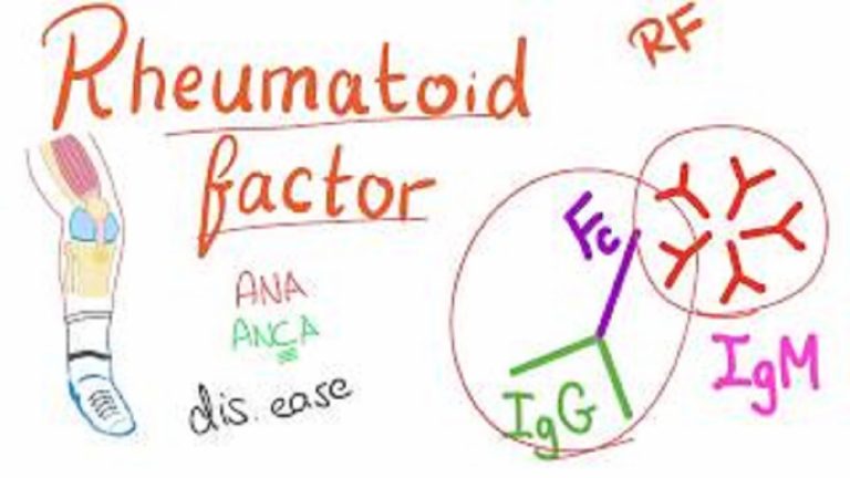 what-is-rheumatoid-factor-scholar-idea